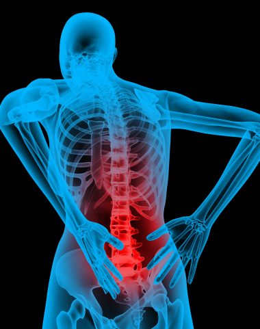 back pain